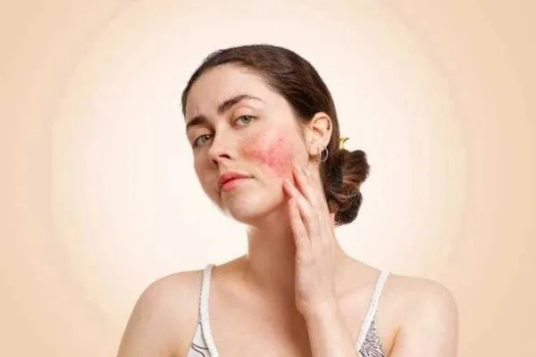 compressed skin diseaes1